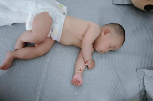 台山宝宝脸上有白色斑块